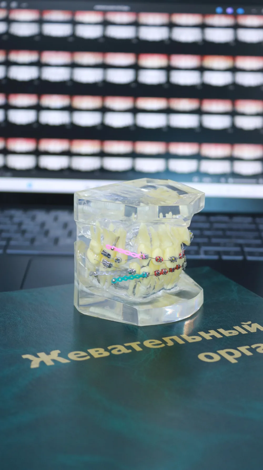 Ортодонтия в Ташкенте в Denturon Dental Clinic